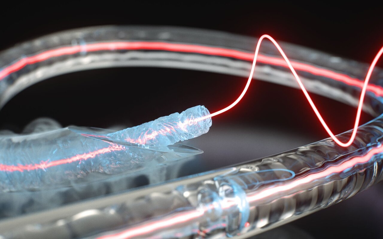 Gelée à -196 °C, une fibre optique emprisonne la lumière et la restitue sur demande : un seuil inédit qui redéfinit le stockage optique quantique