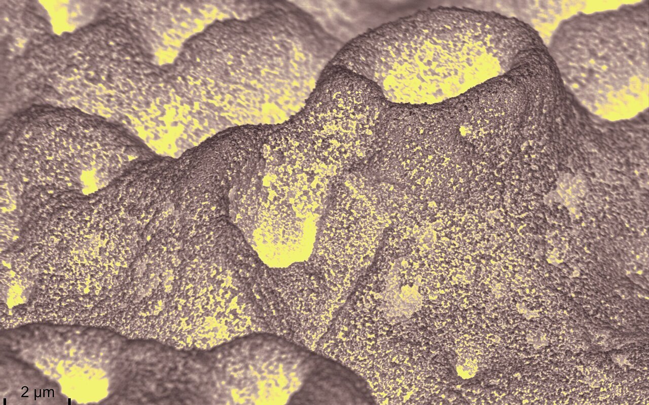 Surface de vis de titane avec pores en forme de volcan recouverts de nanoparticules de ZnO