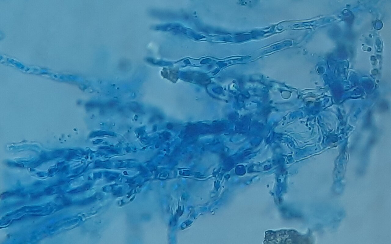 Vue microscopique montrant des hyphes septées et ramifiées d'Aspergillus en préparation LPCB
